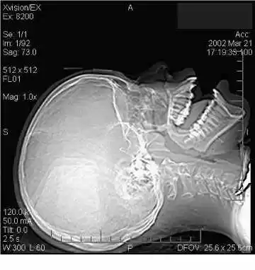 Estudo Radiográfico do Crânio  Resumos Diagnóstico por Imagem