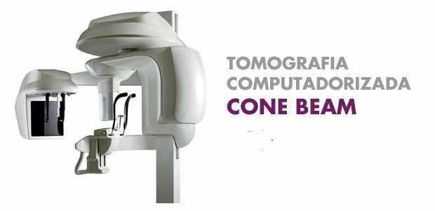 Figura 6: TC Cone Beam