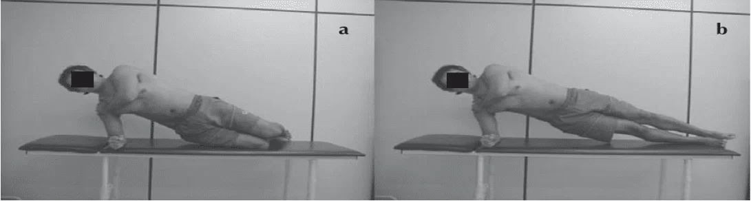 Ponte lateral: em (a) o suporte do peso do corpo inferior com os joelhos sobre a plataforma (nos casos de maior preocupação com a segurança do segmento lombar, nesta posição há redução da demanda adicional); em (b) o suporte inferior com os pés aumenta o recrutamento muscular, mas também aumenta a carga na coluna. Fonte: França et al, 2008.