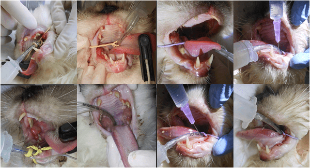 Procedimento cirúrgico visando a retirada dos granulomas durante o qual foram infundidas CTMs-TAF tanto pela via endovenosa como intra gengival.