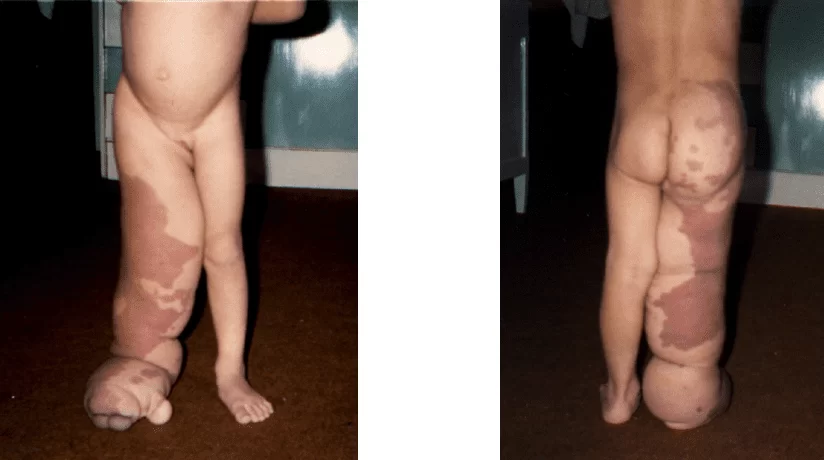 Figure 2 - Three years old.