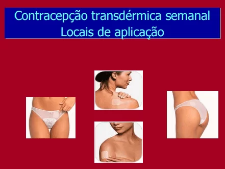 Figura 4 – Contracepção transdérmica semanal. Fonte: (33)