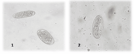 Figura 1: Ovos de nematóides da Superfamília Strongylidae (1). Ovo de Oxyuridae (2) detectado nos exames coproparasitológicos de jabutis. Laboratório de Doenças Parasitárias, Niterói, Rio de Janeiro. 2016.