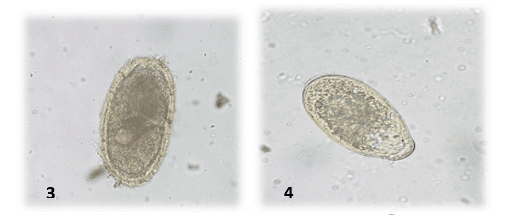 Figura 2: Ovo de Ascarididae () e de Trematoda (2) detectados nos exames coproparasitológicos de jabutis. Laboratório de Doenças Parasitárias, Niterói, Rio de Janeiro. 2016.