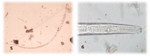Figura 3: Larvas de Labiduris spp (1 e 2) detectadas nos exames coproparasitológicos de jabutis. Laboratório de Doenças Parasitárias, Niterói, Rio de Janeiro. 2016.