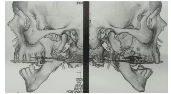 Odontologia veterinária: Fraturas de mandíbula e maxila - Blog do