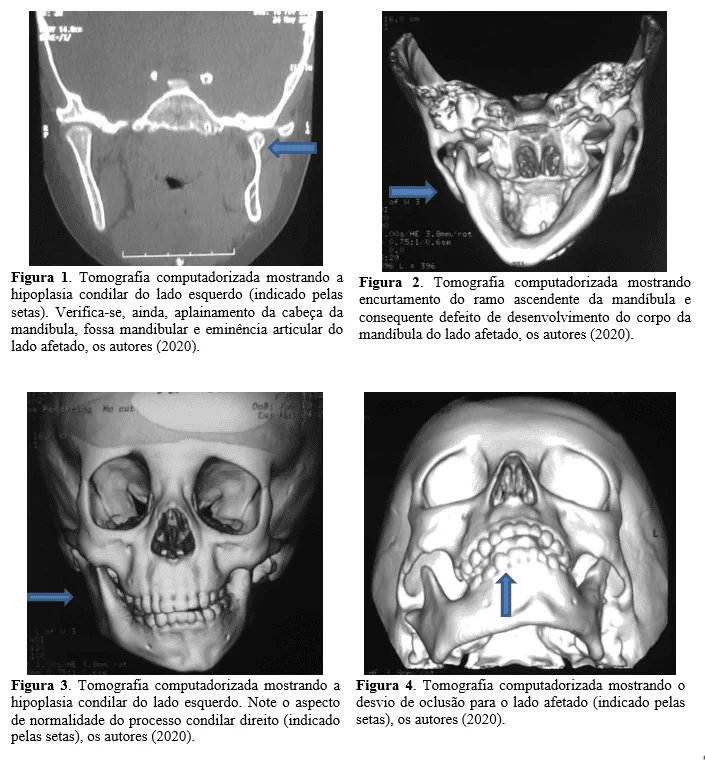 atm mandibular - Consulta Ideal