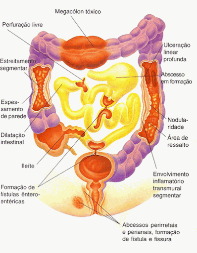 Fisiologia Do Processo Inflamatório, PDF, Inflamação