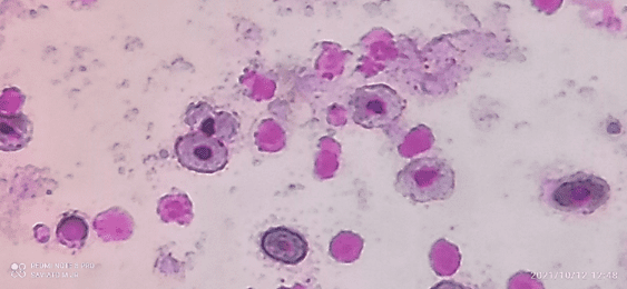A. novae blood smear illustrating apparently healthy blood cells.