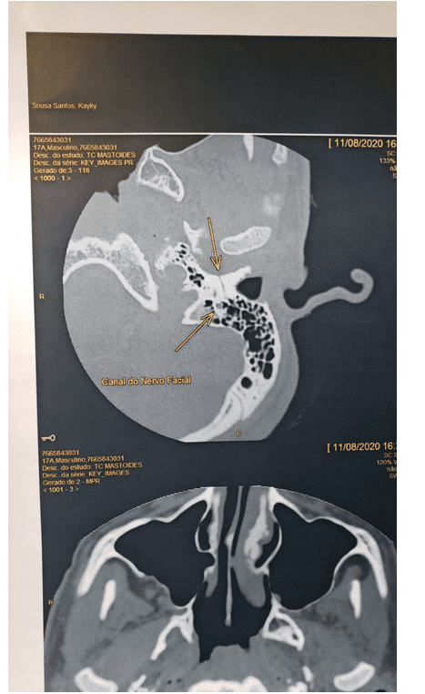 TC DE MANDIBULA • AMD Saúde