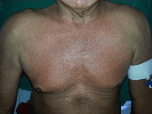 Hipertrofia muscular no peitoral
