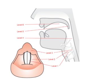 Os níveis do trato vocal (formantes)