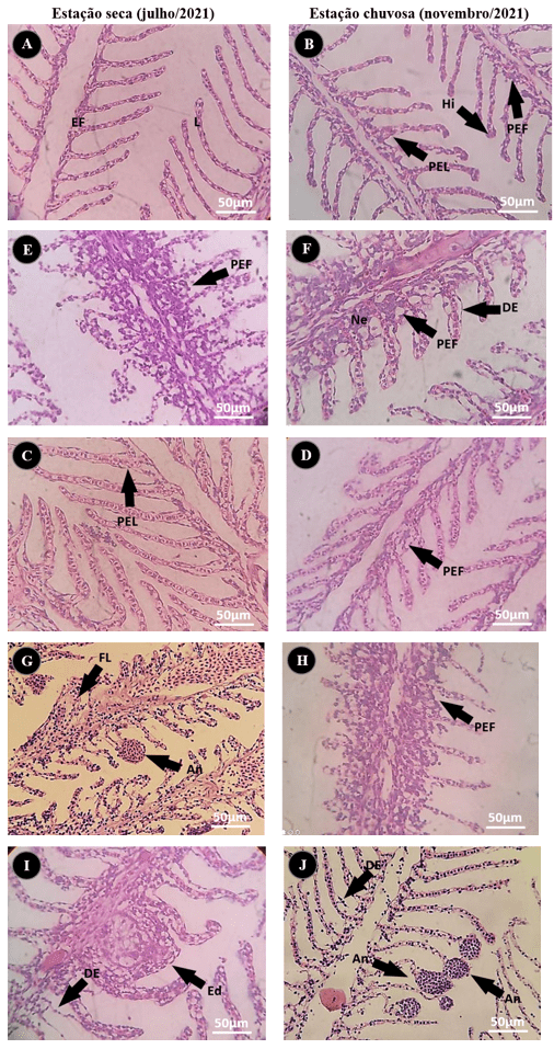 Microfotografias das alterações histopatológicas branquiais observadas nos exemplares de Salminus hilarii capturados nos pontos de coleta no rio estudado, GO.