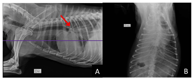Imagem de radiografia pulmonar.