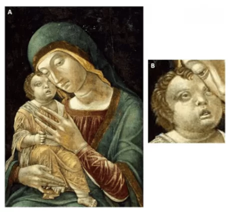 Figura 1 - pittura "Madonna col Bambino" di Andrea Mantegna - Mantova, Italia. Fonte: Sposta giù. Disponibile all'indirizzo: <http://www.movimentodown.org.br/2015/05/sindrome-de-down-na-historia-parte-03 srcset=
