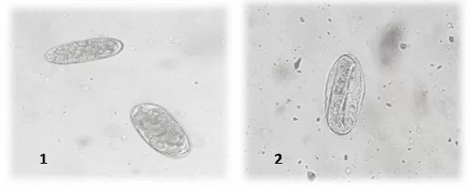 Figura 1: Ovos de nematóides da Superfamília Strongylidae (1). Ovo de Oxyuridae (2) detectado nos exames coproparasitológicos de jabutis. Laboratório de Doenças Parasitárias, Niterói, Rio de Janeiro. 2016.