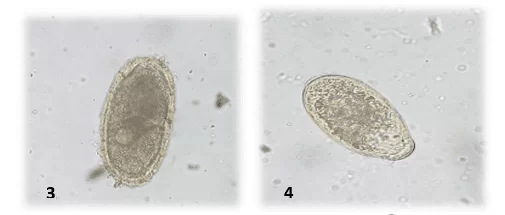 Figura 2: Ovo de Ascarididae () e de Trematoda (2) detectados nos exames coproparasitológicos de jabutis. Laboratório de Doenças Parasitárias, Niterói, Rio de Janeiro. 2016.