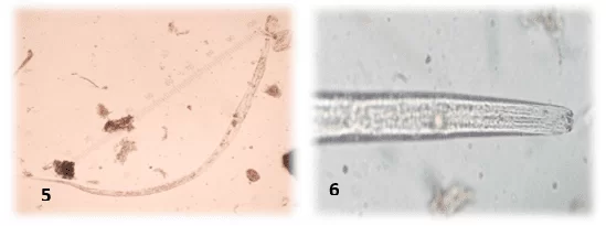 Figura 3: Larvas de Labiduris spp (1 e 2) detectadas nos exames coproparasitológicos de jabutis. Laboratório de Doenças Parasitárias, Niterói, Rio de Janeiro. 2016.
