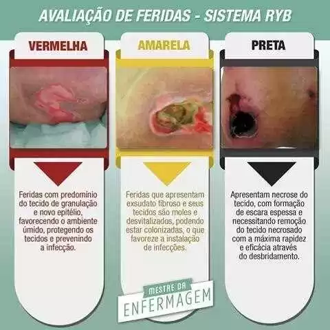 Figura 5: clasificación del sistema rojo, amarillo, negro. Fuente: topsy heridas uno.