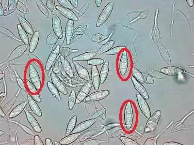 Figura 1 – Exame microscópico direto dos macroconídeos (círculo vermelho) que caracterizam o Microsporum canis presentes na amostra do rato (Rattus norvergicus).