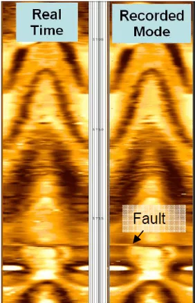 Comparação entre perfis de imagem obtido em tempo real (esquerda) e gravado em RM (direita), mostrando visivelmente uma falha em ambos