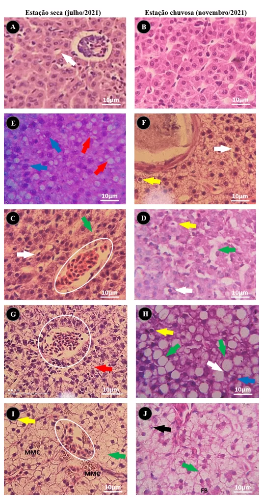Alterações histopatológicas em fígado de Salminus hilarii no gradiente das seções de coleta, do ponto 01 ao ponto 05