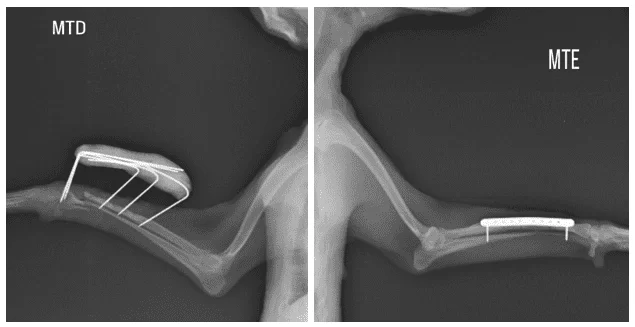 Imagem radiográfica de canino, fêmea, 5 anos, após a segunda cirurgia de osteossíntese com fixador esquelético externo em MTD e retirada de parafusos em MTE