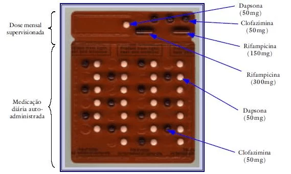 Multibacillary scheme for child
