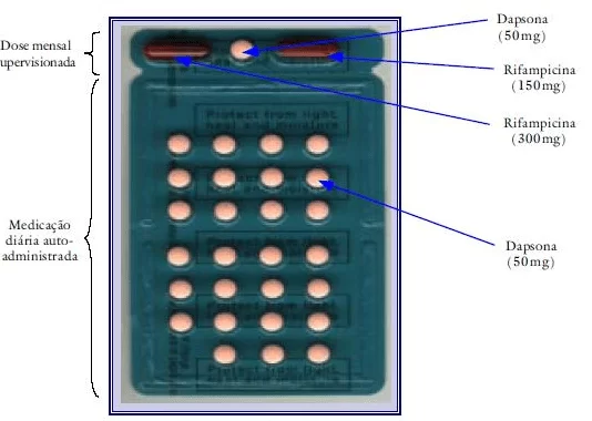 Paucibacillary scheme for child