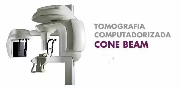 Figura 6: TC Cone Beam 