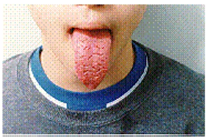 Lengua grande, que sobresale inferior y ranurado