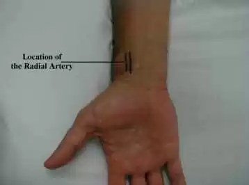 https://meded.ucsd.edu/clinicalmed/extremities_normal_radial.jpg