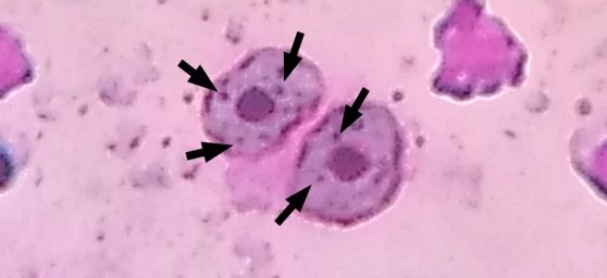 A. novae blood smear, illustrating blood cells, with the presence of micronuclei (arrows).