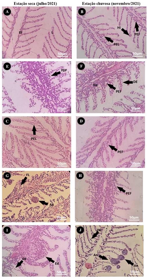 Microfotografias das alterações histopatológicas branquiais observadas nos exemplares de Salminus hilarii capturados nos pontos de coleta no rio estudado, GO.