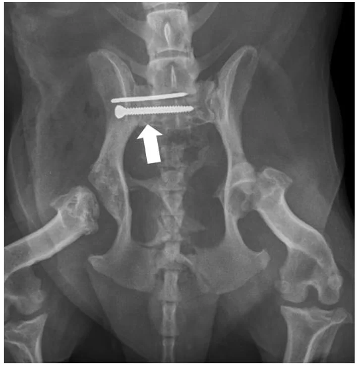 Cão, sem raça definida, 7 anos e 1 mês, 16 kg. Exame radiográfico em posição ventro-dorsal evidenciando a fixação das estruturas com parafusos (seta branca).
