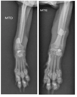 Imagem radiográfica de canino, fêmea, 5 anos com fratura transversa bilaretal de rádio e ulna.