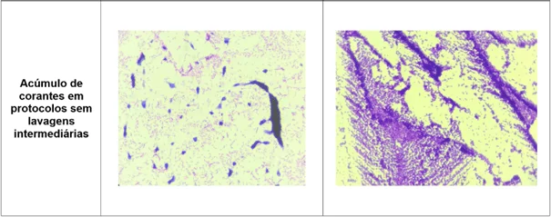 Registro fotográfico das principais alterações microscópicas identificadas nos protocolos de coloração de Gram realizados - Acúmulo