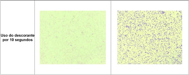 Registro fotográfico das principais alterações microscópicas identificadas nos protocolos de coloração de Gram realizados - Descorante