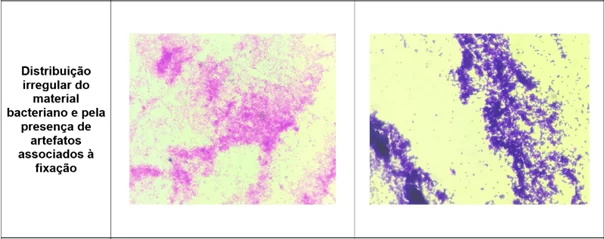 Registro fotográfico das principais alterações microscópicas identificadas nos protocolos de coloração de Gram realizados - Distribuição 2