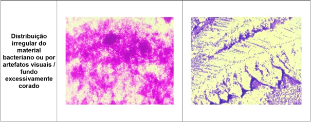 Registro fotográfico das principais alterações microscópicas identificadas nos protocolos de coloração de Gram realizados - Distribuição
