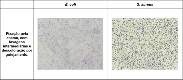 Registro fotográfico das principais alterações microscópicas identificadas nos protocolos de coloração de Gram realizados - Fixação