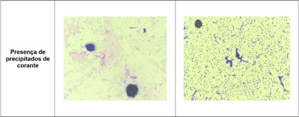 Registro fotográfico das principais alterações microscópicas identificadas nos protocolos de coloração de Gram realizados - Presença